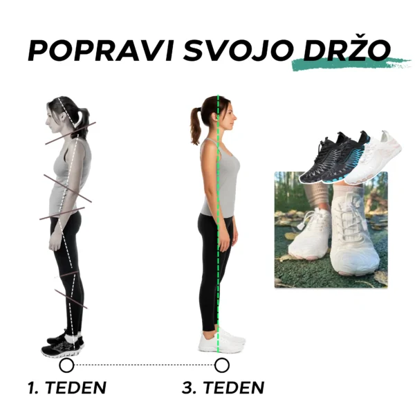 🔥Časovno omejen 50 % popust, najbolj priljubljeni ortopedski čevlji za boso nogo leta 2025, 3 dni za lajšanje bolečin v stopalih