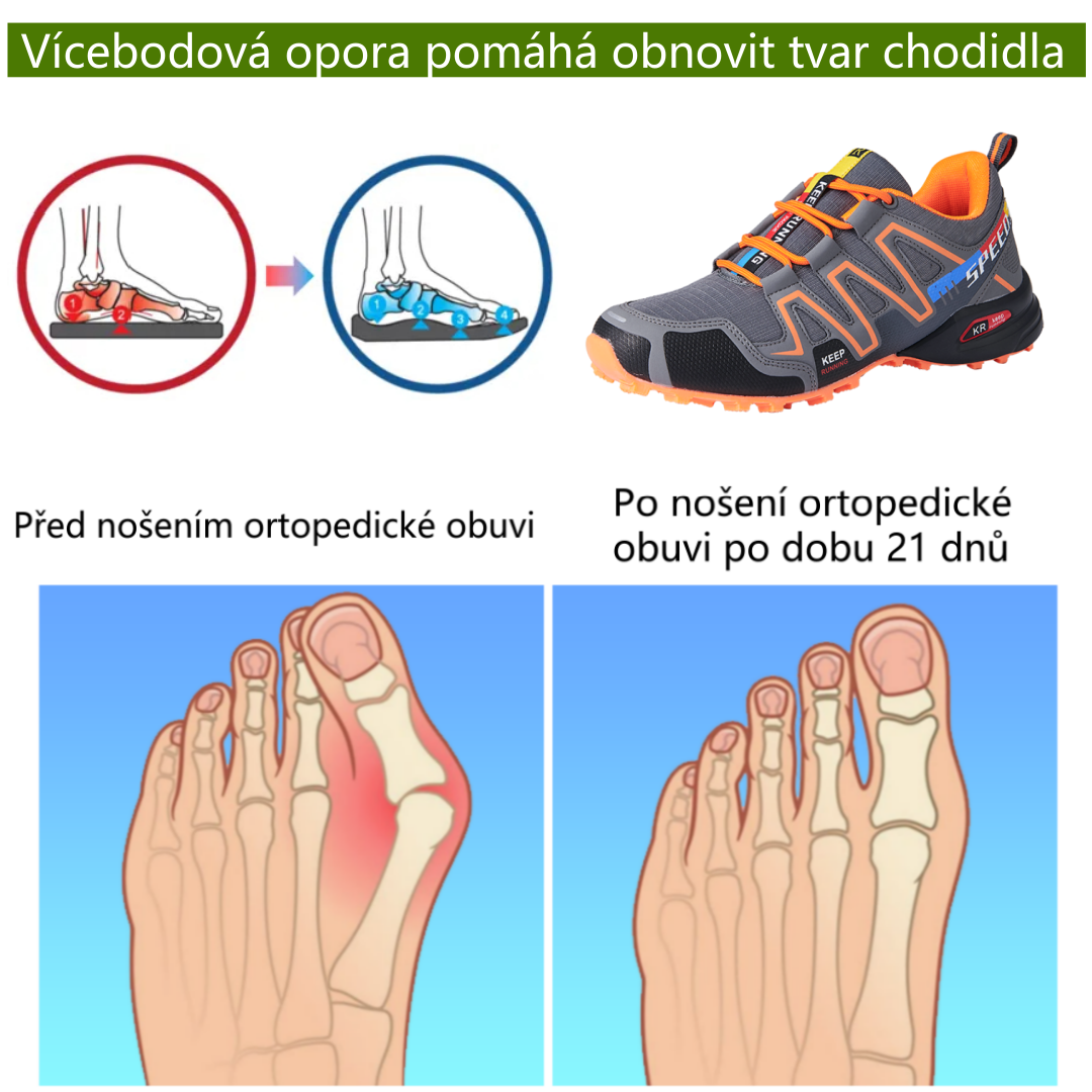 ⚡Omezený sleva 50 % - Ergonomické ortopedické boty - Pro úlevu od bolesti nohou, zad a kloubů - Unisex